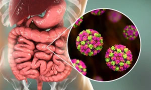 norovirus foto shutterstock