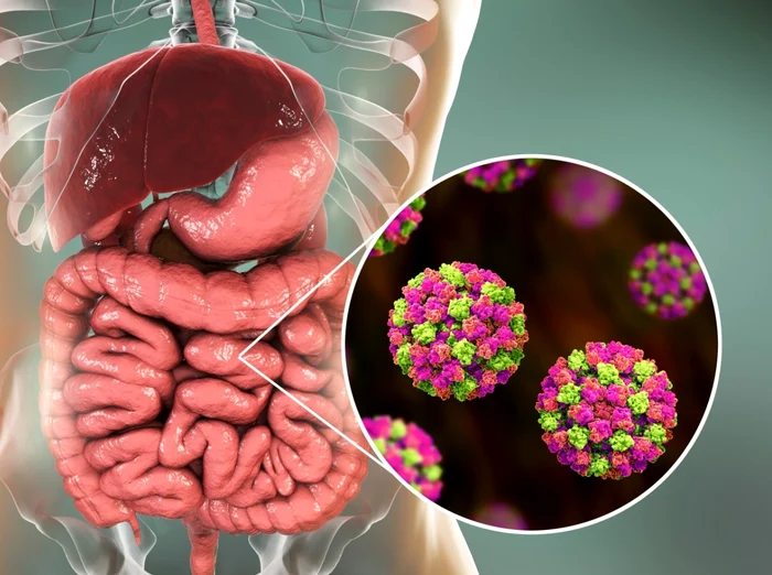 Norovirusul este o infecție gastro-intestinală extrem de contagioasă. FOTO Shutterstock