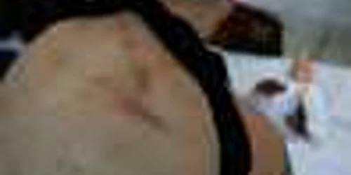 Bătăușii au ajuns la spital. Foto arhivă Adevărul