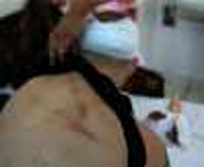 Bătăușii au ajuns la spital. Foto arhivă Adevărul