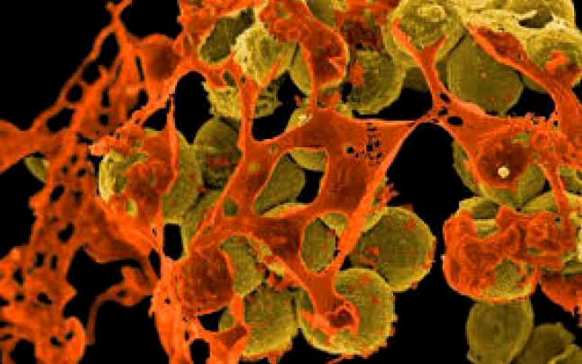 bacterii intraspitalicesti
