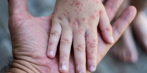 xptho6 1c057ef4ee4d32a0707c95f3bb9b9d4e webp