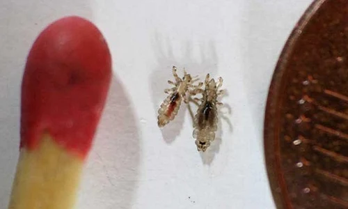 1 scapa de paduchi cu ajutorul unui remediu natural mai simplu de atat nu se poate 3ovr jpg jpeg