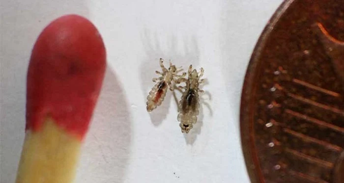 1 scapa de paduchi cu ajutorul unui remediu natural mai simplu de atat nu se poate 3ovr jpg jpeg