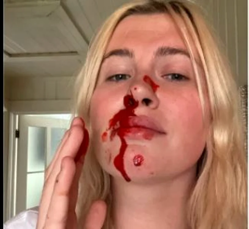 
    Irekand a scris că i s-a întâmplat în timp  ce făcea ăe bonaFoto: Instagram  