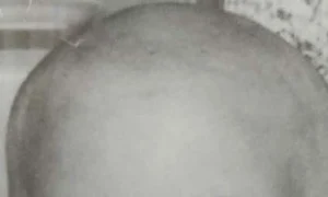 Aşa arăta Aurel  când a fost infiat  jpeg