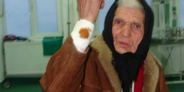 Bătrâna a fost tăiată la mâna cu coasa