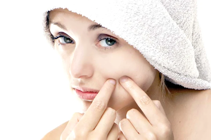 Nu orice ulei este bun pentru tenul acneic pentru că, dacă nu se absoarbe rapid în piele, astupă porii şi mai mult rău face (Fotografii: Shutterstock)