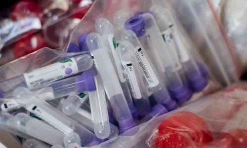 1 test pentru covid 19 jpg jpeg