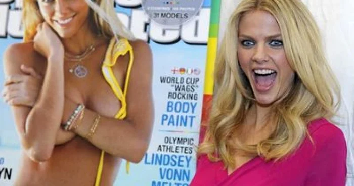 Brooklyn Decker (FOTO: EPA)