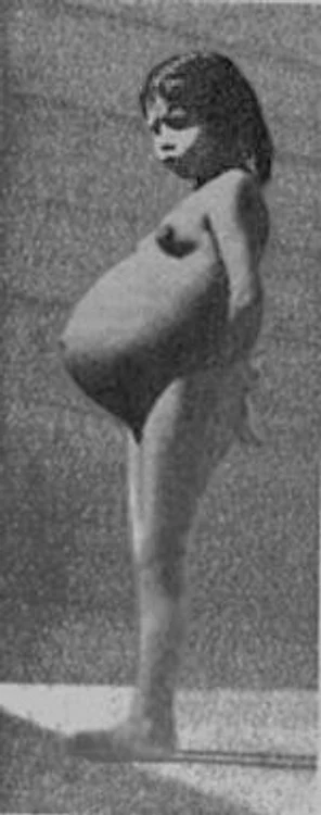 Lina Medina