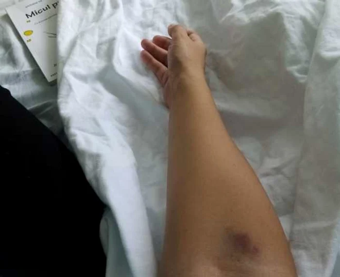 Urmele tratamentelor injectabile sunt totuşi răul cel mai mic 