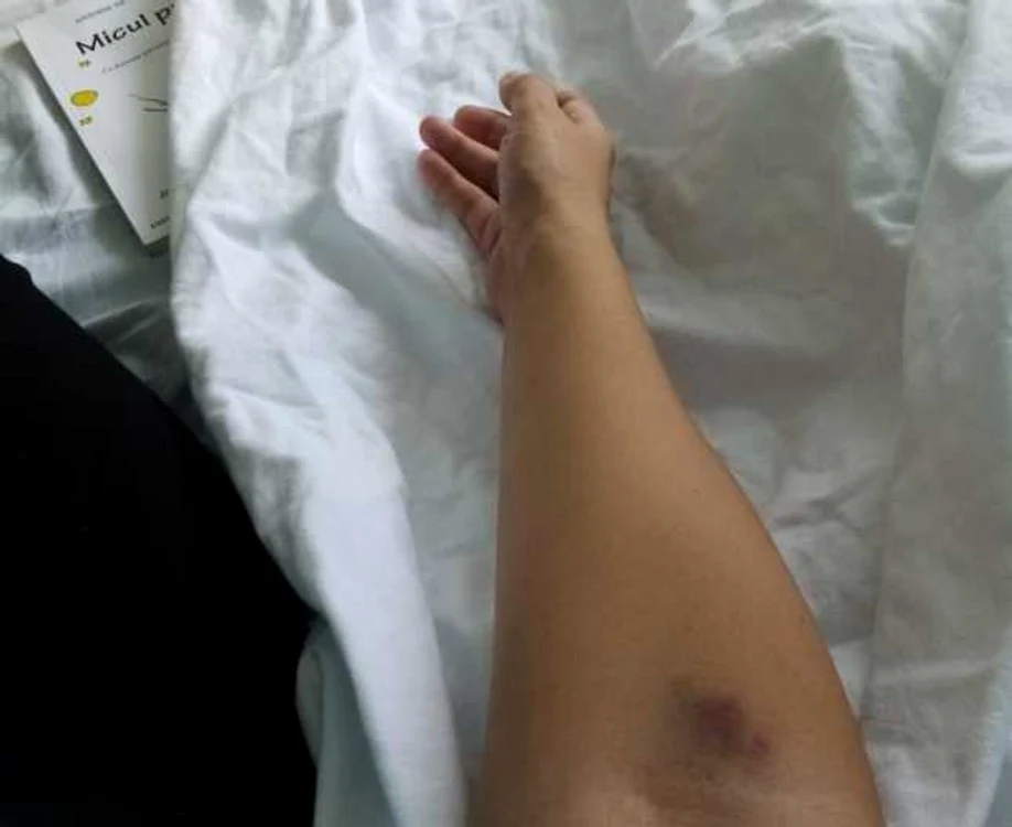 Urmele tratamentelor injectabile sunt totuşi răul cel mai mic 