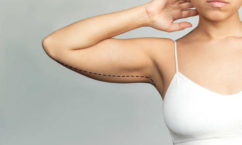 brațe lăsate  foto   Shutterstock jpg