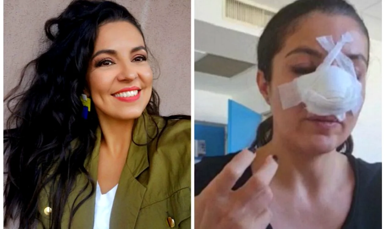 Cristina Joia a avut nevoie de două operaţii şi alte proceduri, după atac foto: Arhivă