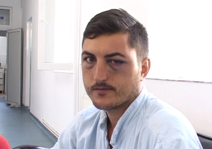 Gheorghiţă Ciobanu s-a ales cu o fractură FOTO: Gorj TV