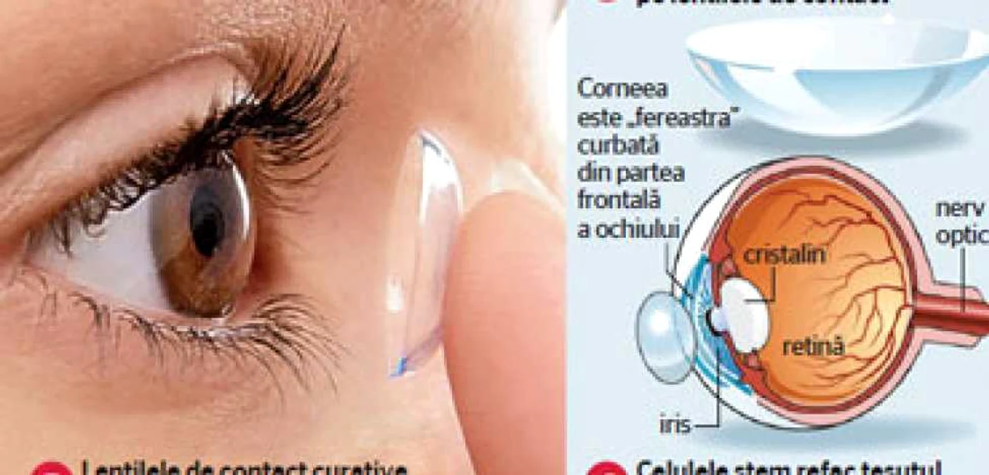 Lentile de contact  care redau vederea