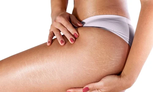 1 vergeturi jpg jpeg