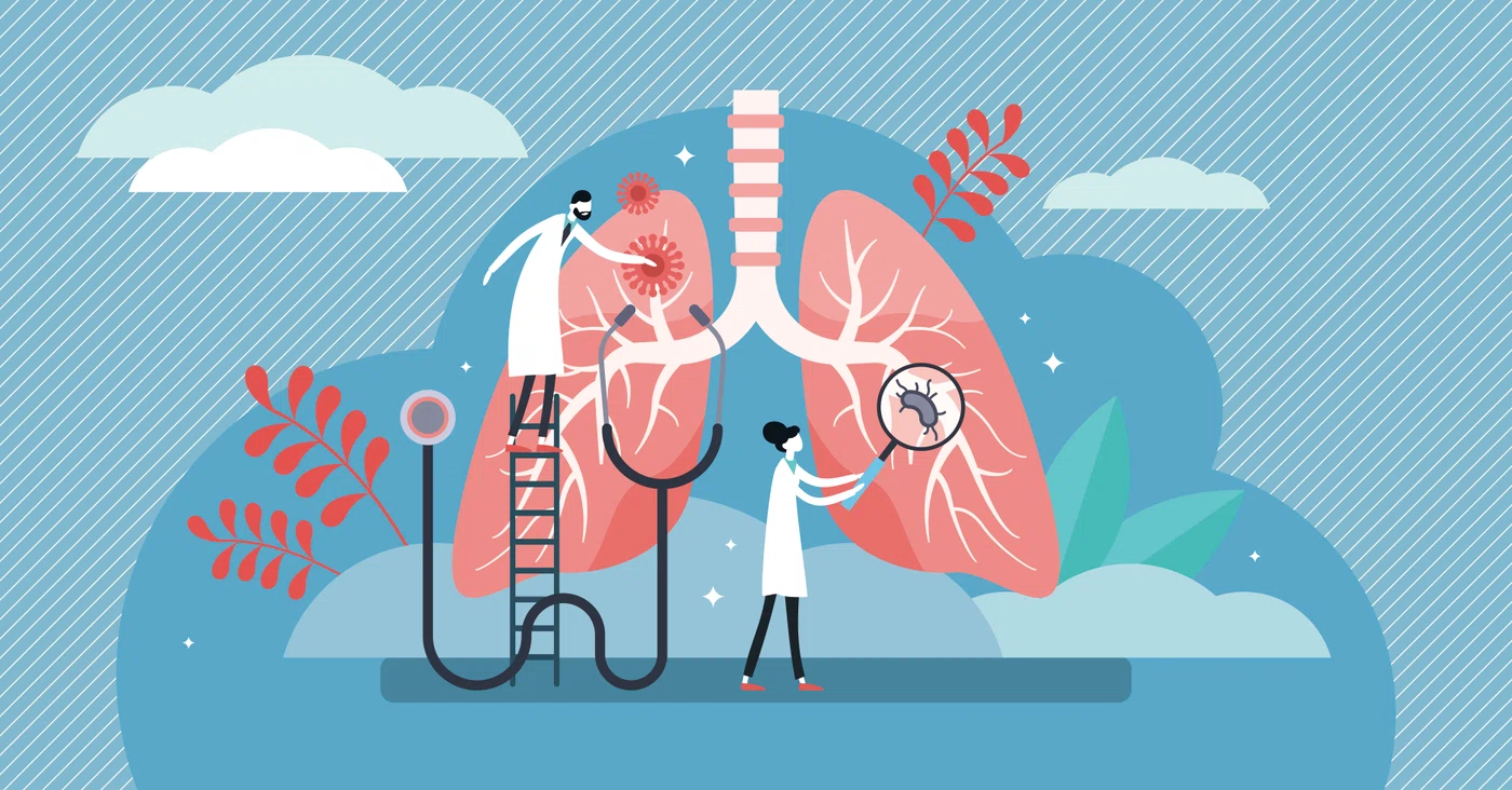 Principalele cauze ale cancerului bronhopulmonar sunt fumatul și poluarea. FOTO: Shutterstock
