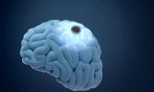 implant creier istock jpg