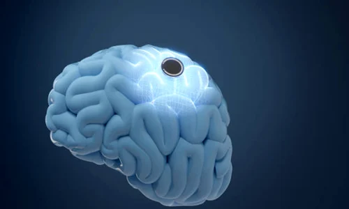 implant creier istock jpg