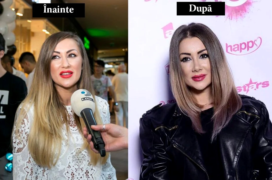 Raluca Tănase s-a schimbat foarte mult după rinoplastie