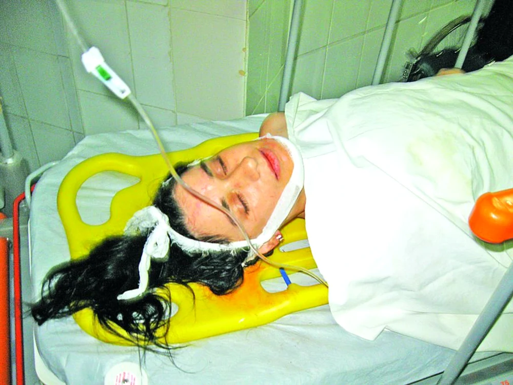 
    Victoriţa Sârbu  s-a ales cu dinţii  sparţi şi cu un  traumatism la coloană  