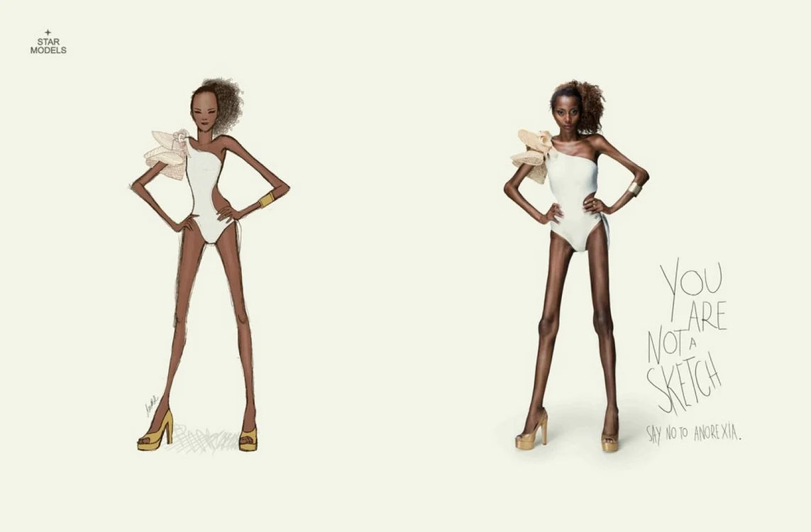 anorexica 1