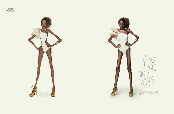 anorexica 1