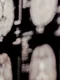image png