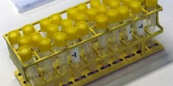 OMS: Toate ţările vor avea nevoie de vaccin împotriva noii gripei
