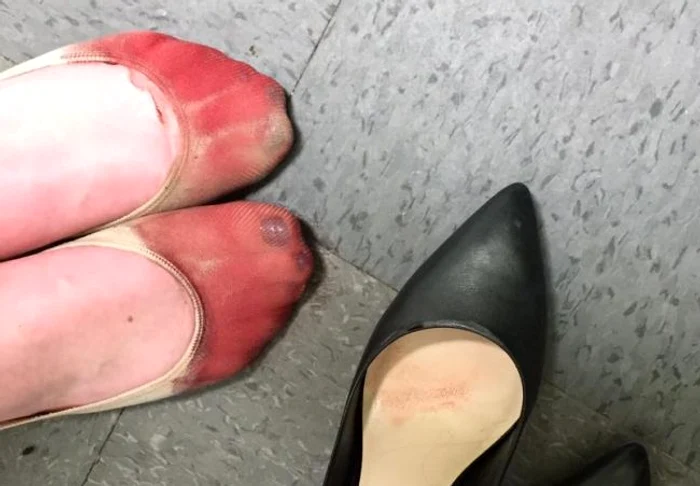 
    Picioarele unei chelnerițe s-au umplut de sânge după o tură pe tocuriFoto: Facebook  