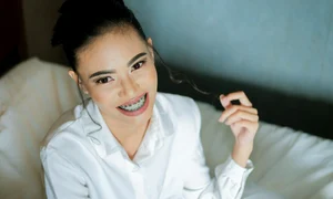 femeie cu aparat dentar zambind(1) jpg