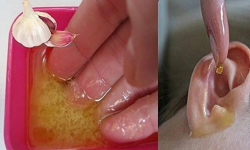 1 ai probleme cu auzul pune ti doua picaturi din tinctura asta miraculoasa in ureche dyx8 jpg jpeg