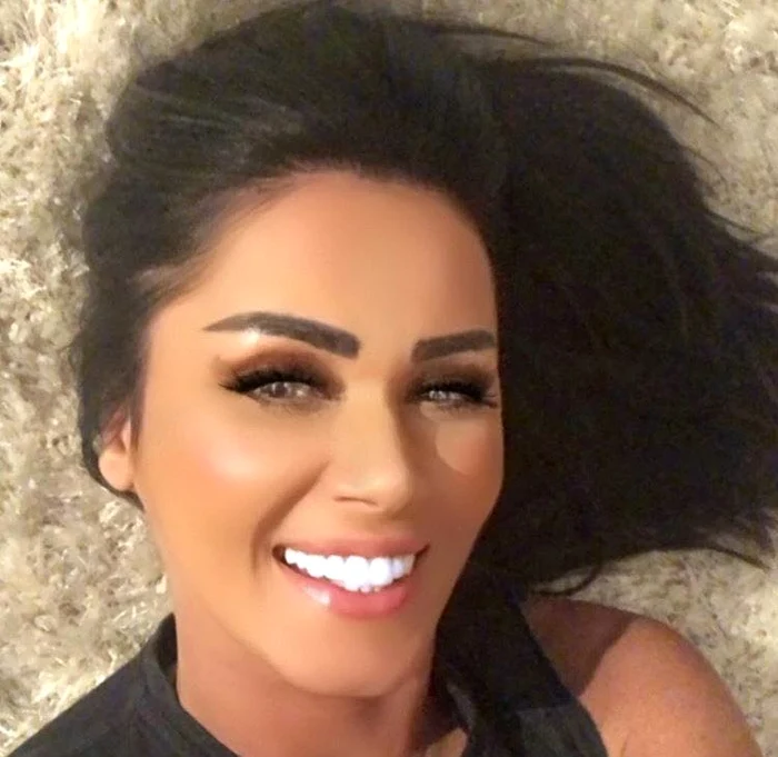 Oana Zăvoranu și-a pus fațete dentare vara trecută