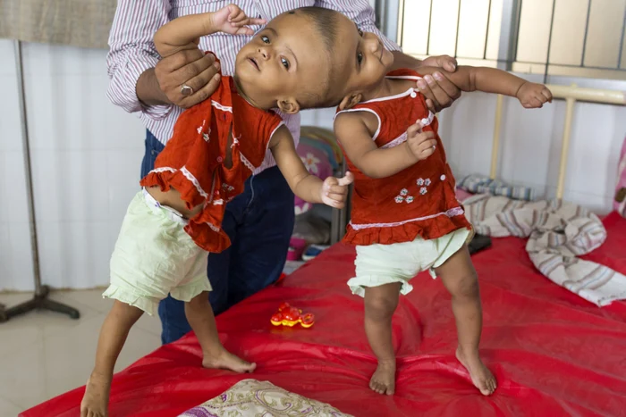 Micuţele vor fi supuse unei inetrvenţii