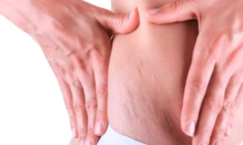 1 79087 original jpg jpeg