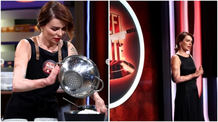 Oana Rotariu, supraviețuitoare a incendiului Colectiv - Foto: Instagram