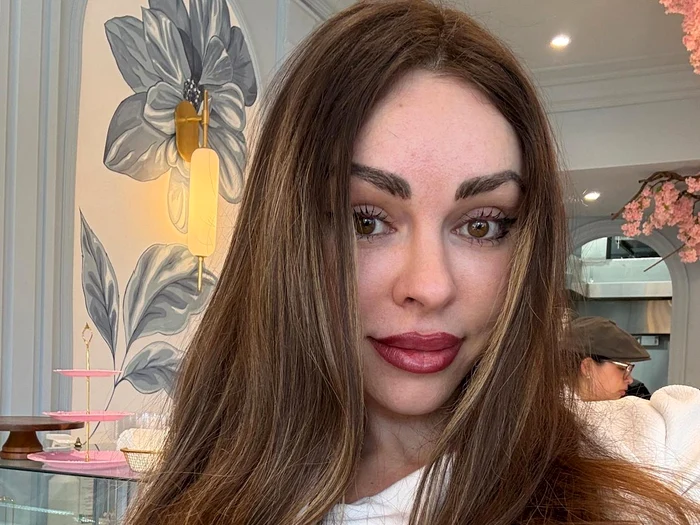 Este mulțumită de rezultatele operației / foto: Mathilde Turco