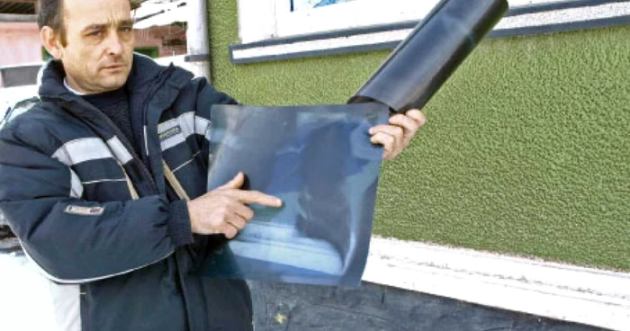 Viorel Negrilă s-a întors acasă cu tot cu lama de cuţit în spate. Foto: D. Guţă