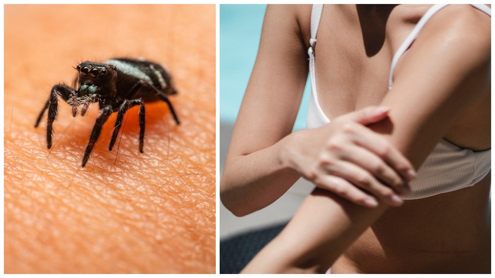 Cum ne protejăm pielea de insecte, pe timpul verii 