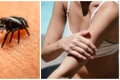 intepături insecte