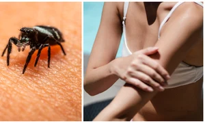 intepături insecte