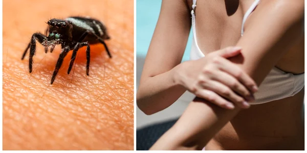 intepături insecte
