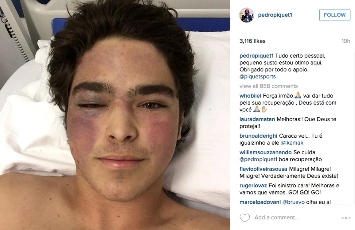 Pedro Piquet şi-a expus rănile pe Facebook