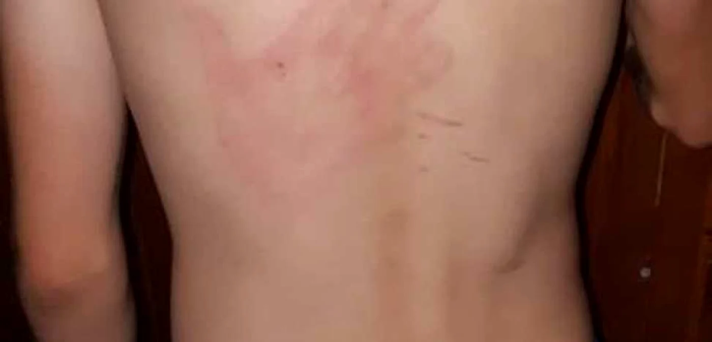 Urma loviturii primită de băiatul de 14 ani
