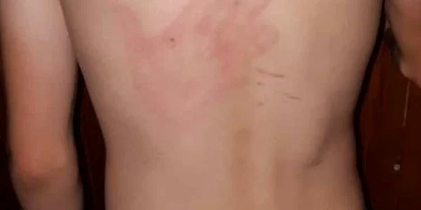 Copil de 14 ani lovit de administratorul salii polivalente din Tulcea Sursa Facebook Simona Covaliov