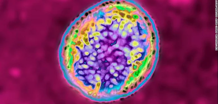 Cazurile de infecție cu o bacterie periculoasă au crescut alarmant în Japonia