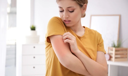 piele   mancarimi   shutterstock 1421544041 jpg