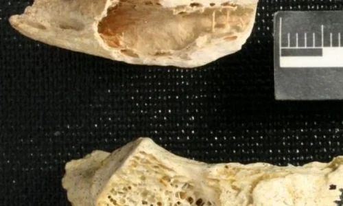 A fost descoperită cea mai veche tumoare jpeg